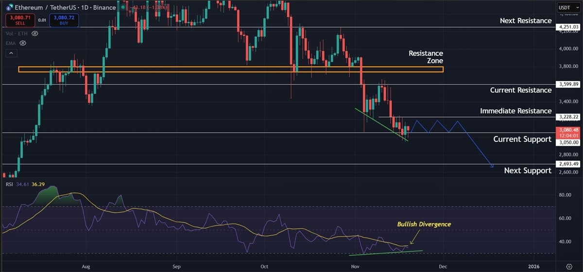 Ethereum (ETH) Price Prediction: Pressure Builds as Crucial Support Comes Into Focus